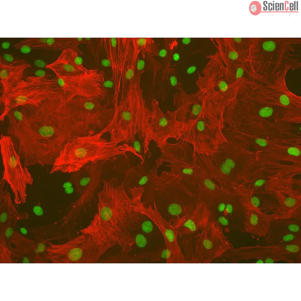 Rat Hepatic Stellate Cells (RHSteC) - Immunostaining for α-SMA, 200x.
