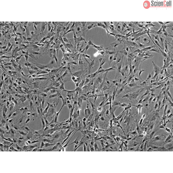 Rat Meningeal Cells (RMC) - Phase contrast, 100x.
