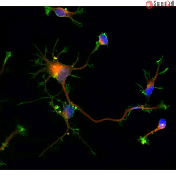 Rat neurons - cortical (R1520) - Immunostaining for Beta Tubulin III (red) and F-actin (green), 600x