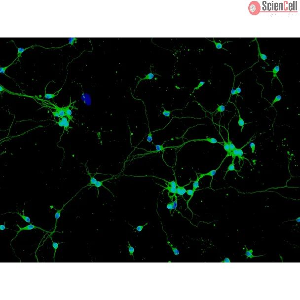 Rat Neurons-spinal cord (RN-sc) - Immunostaining for β-Tubulin III, 200x.

