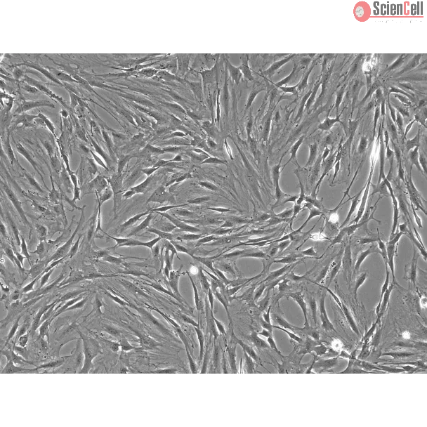 Rat Pulmonary Artery Smooth Muscle Cells (RPASMC)- Phase Contrast, 100x