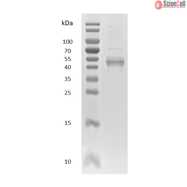 Recombinant Human NFkB