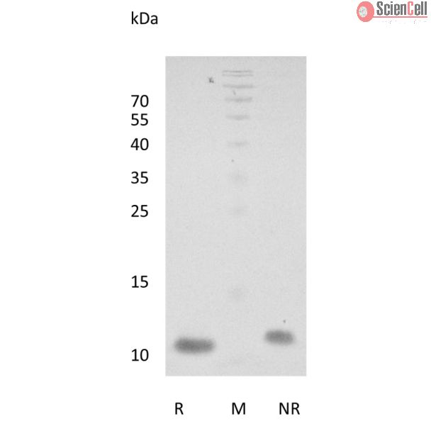 Recombinant Human NRG-1 (EGF-like domain) Beta 2：重组人NRG-1（EGF样结构域）Beta 2