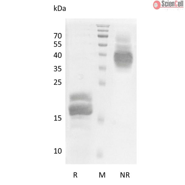 Recombinant Human Vascular Endothelial Growth Factor B