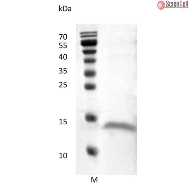 Recombinant Human Vascular Endothelial Growth Factor D