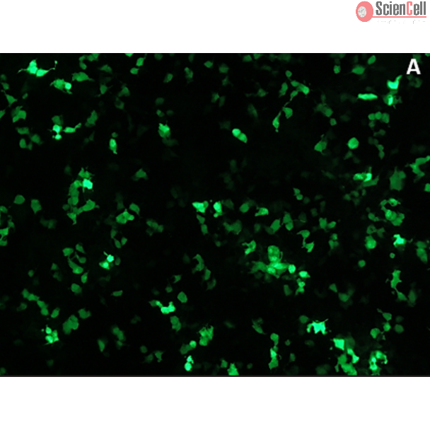 Transfection Max Medium - TMM