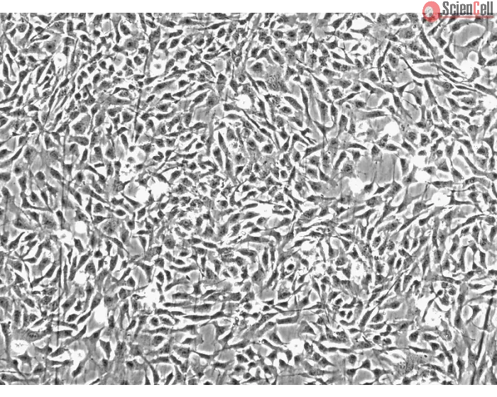人类关节软骨细胞 (HC-a) - 相差显微镜，100倍放大。