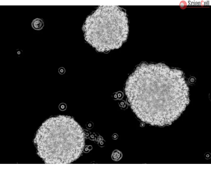 人类少突胶质前体细胞-寡球体 (HOPC-os) - 相位对比，200倍。