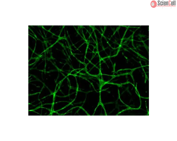 Resultant endothelial tubules from Cat 8728 stained with CD31 using this 3D Gel Staininig Prep Kit