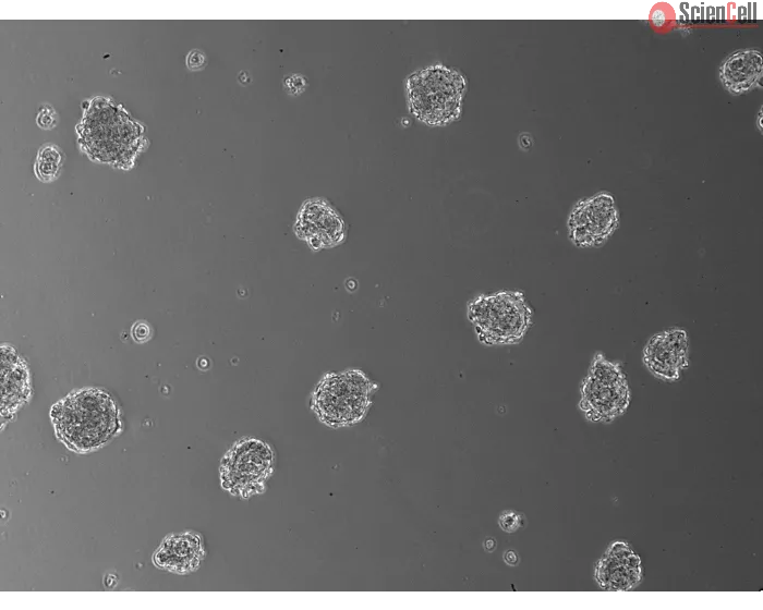 Days 3; 3D Human Blood Brain Barrier Spheroids (At 100X magnification). 