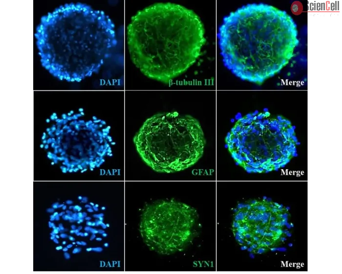 Human Cortical Spheroids at Day 7