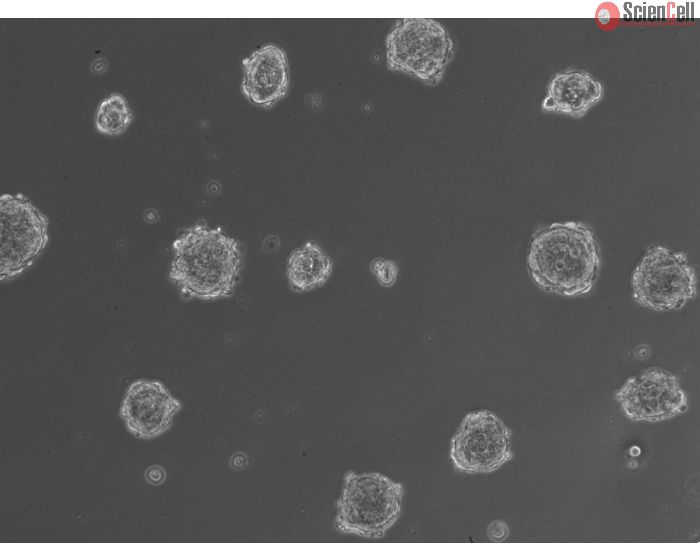 3D hepatic stellate cell spheroids at day 2