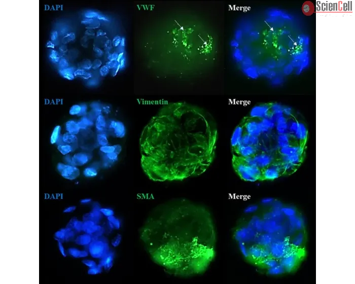 Immunostaining of the co-culture spheroids with the stellate cell markers (Vimentin and Smooth Muscle Actin) and the endothelial cell marker Von Willebrand Factor.