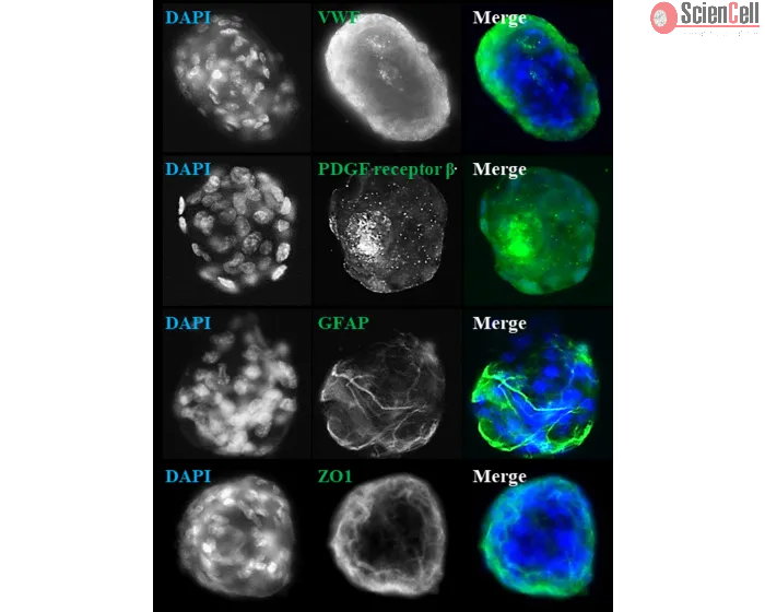 Days 7; IF analysis of rat blood brain barrier spheroids