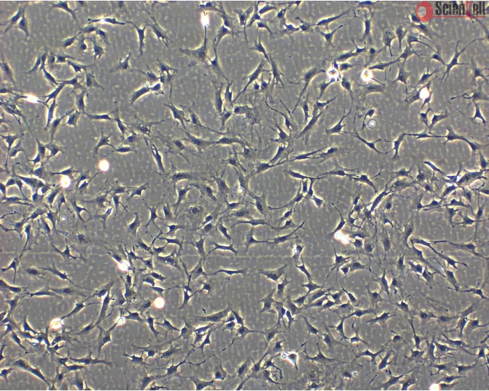 Phase Contrast Caption: Bovine Astrocytes (BA)- Phase Contrast, 100x
