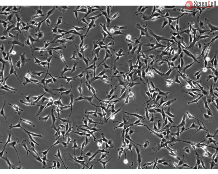 Bovine Dermal Fibroblasts (BDF)-Phase contrast, 100x