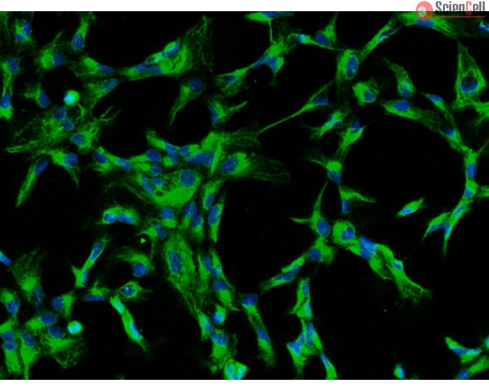 Bovine Lens Epithelial Cells (BLEpiC)-Immunostaining for CK-18, 200X.