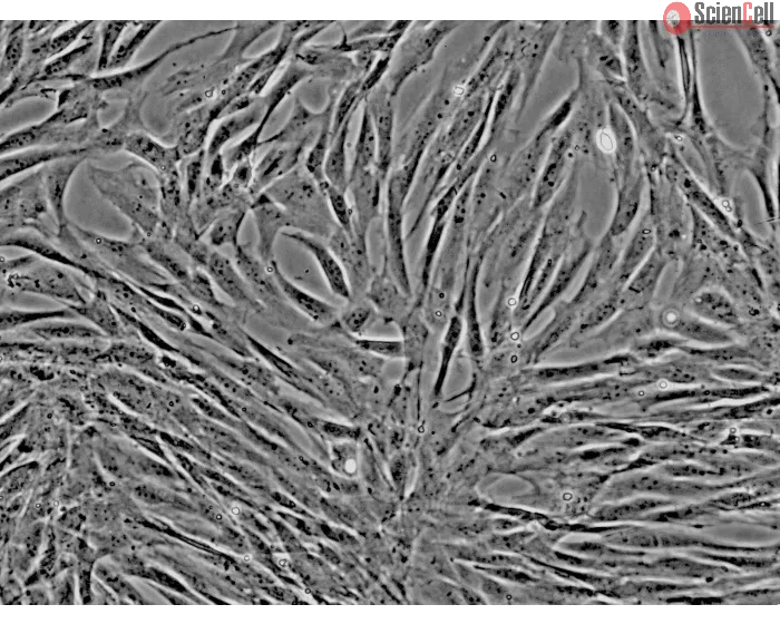 Dog Mesenchymal Stem Cells-adipose (DMSC-ad) - Phase contrast, 200x.
