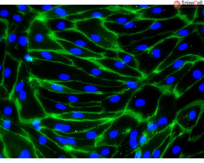 HiPSC-Derived Endothelial Cells (HiPSC-EC) -
Immunostaining for CD31, 200x
