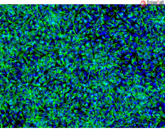 HiPSC-Derived Neural Stem Cells (HiPSC-NSC) - Immunostaining for Nestin, 200x
