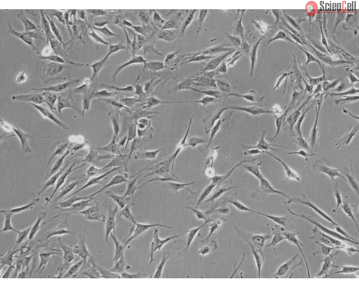 Human Adrenal Cortical Cells (HAdCC) - Phase contrast, 200x.
