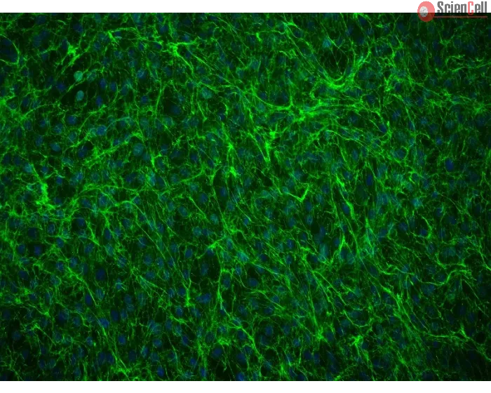 Human Annulus Fibrosus Cells (HAFC) - Immunostaining for Fibronectin, 200x.
