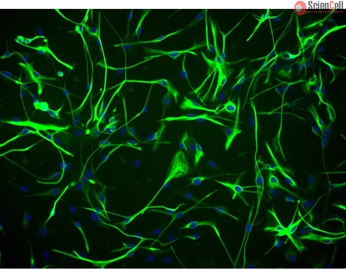 Human Astrocytes-hippocampal (HA-h) - Immunostaining for GFAP, 200x.
