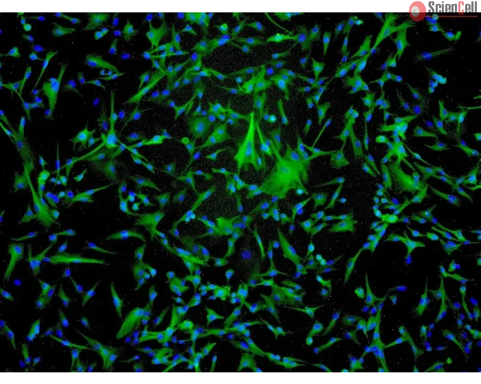 Human Astrocytes-midbrain (HA-mb) - Immunostaining for GFAP, 100x.
