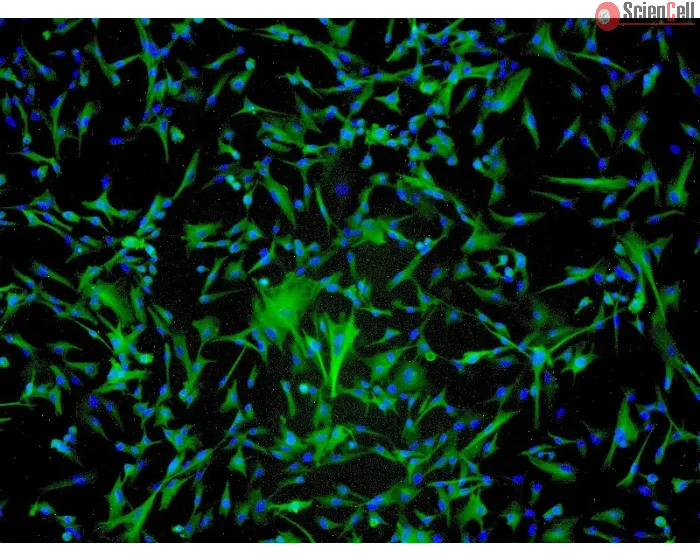 Human Astrocytes-spinal cord (HA-sp) - Immunostaining for GFAP, 100x.
