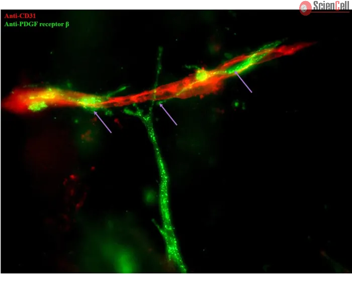 Day 6; Endothelial marker CD31 (red), and pericyte marker PDGF receptor β (green). Purple arrows indicate PDGF receptor β+ pericyte investment on CD31+ endothelial tubules (at 400x magnification).
