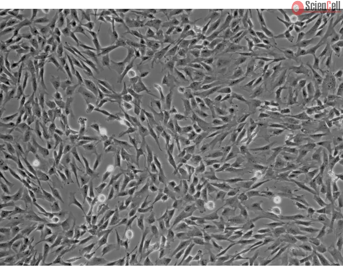 Human Brain Vascular Pericytes (HBVP) - Phase contrast, 100x.
