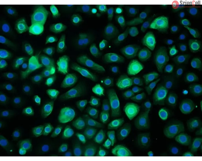 Human Bronchial Epithelial Cells-adult (HBEpiC-a) - Immunostaining for CK-18 200x