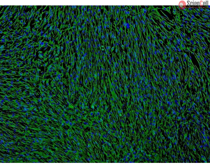 Human Bronchial Fibroblasts (HBF) - Immunostaining for Fibronectin, 100x.
