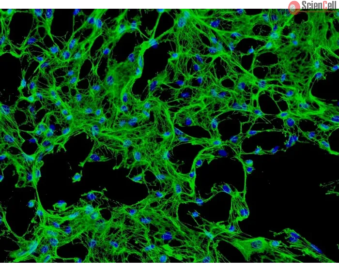 Human Calvarial Osteoblasts (HCO) - Immunostaining for Fibronectin, 200x.
