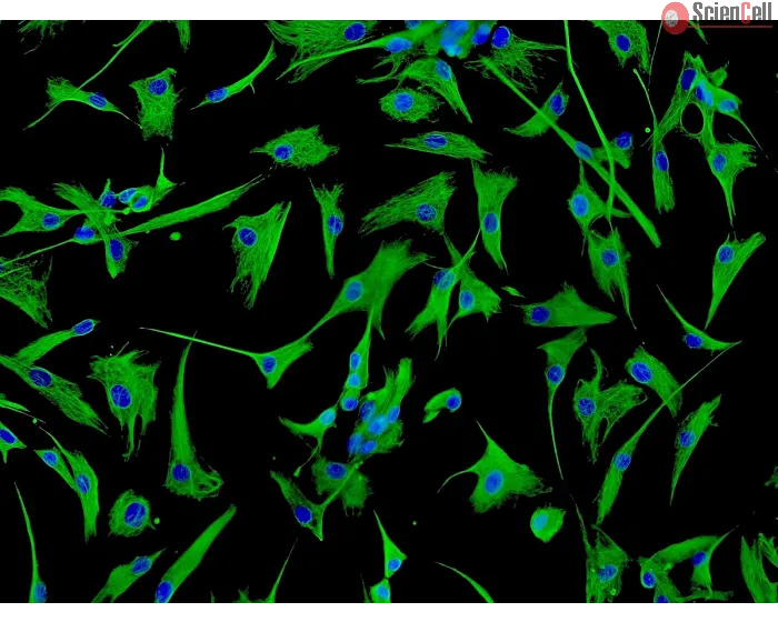 Human Cardiac Fibroblasts-atrial (HCF-aa) - Immunostaining for Vimentin, 200x.