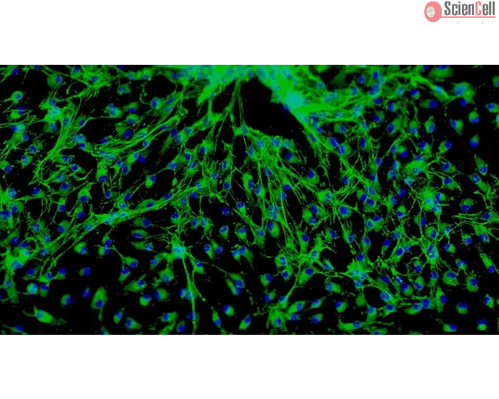 Human Cardiac Fibroblasts-fetal atrial (HCF-fa) - Immunostaining for Fibronectin, 100x.
