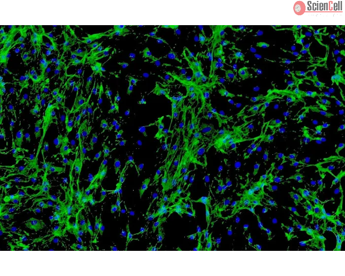 Human Cardiac Fibroblasts-juvenile ventricular (HCF-av) - Immunostaining for Fibronectin, 100x.