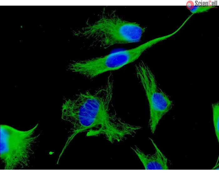 Human Cardiac Fibroblasts (HCF) - Immunostaining for Vimentin, 600x..