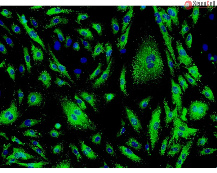 Human Cardiac Microvascular Endothelial Cells (HCMEC) - Immunostaining for vWF, 200x.
