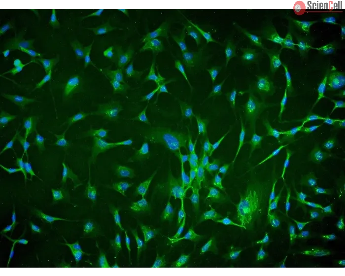 Human Chorionic Mesenchymal Stromal Cells (HCMSC) - Immunostaining for CD105, 200x.
