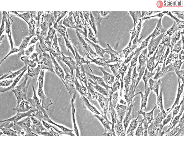 Human Colonic Smooth Muscle Cells (HCoSMC) - Phase contrast, 200x.
