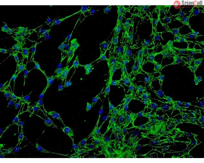 Human Conjunctival Fibroblasts (HConF) - Immunostaining for Fibronectin, 200x.
