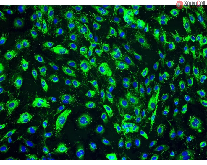 Human Dermal Lymphatic Endothelial Cells (HDLEC) - Immunostaining for vWF, 200x.
