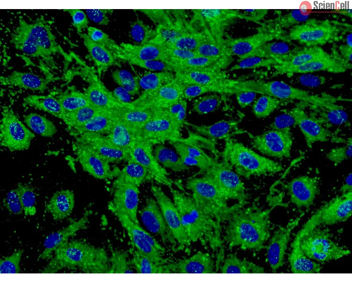 Human Dermal Microvascular Endothelial Cells (HDMEC) - Immunostaining for vWF, 400x.
