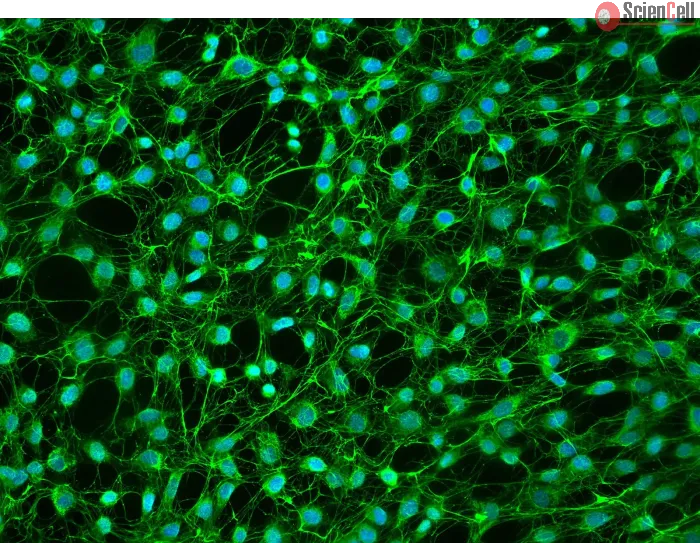 Human Dural Fibroblasts - Immunostaining for FN, 200X
