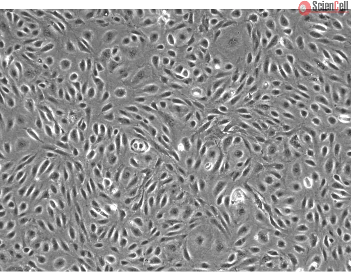 Human Dural Microvascular Endothelial Cells - Phase Contrast, 100X
