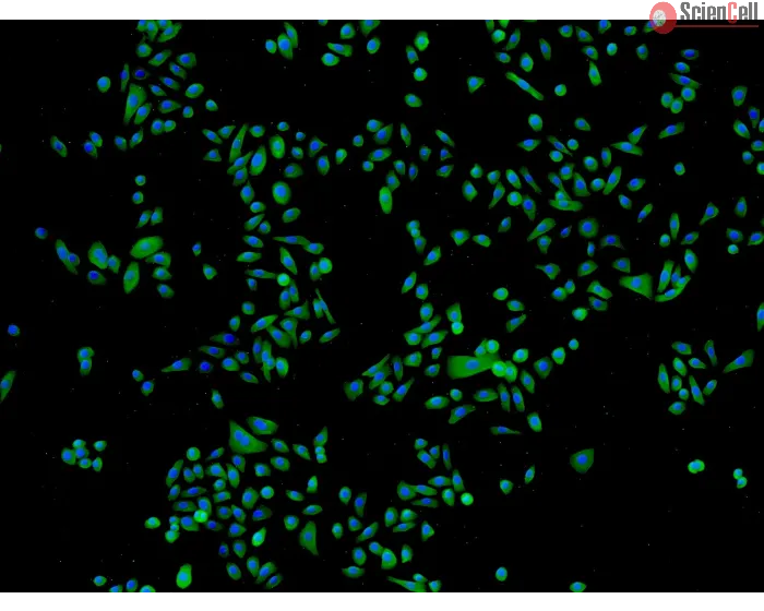 Human Epidermal Keratinocytes-fetal (HEK-f) - Immunostaining for CK-18, 100x.
