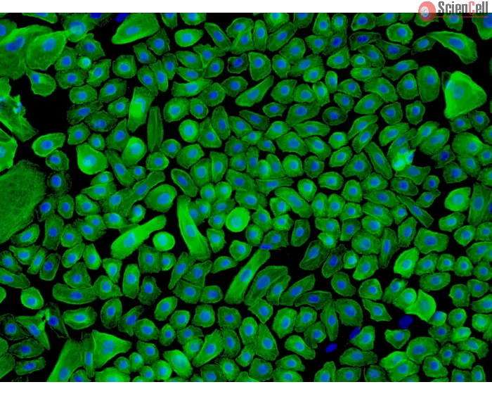 Human Epidermal Keratinocytes-neonatal (HEK-n) - Immunostaining for CK-18, 200x.
