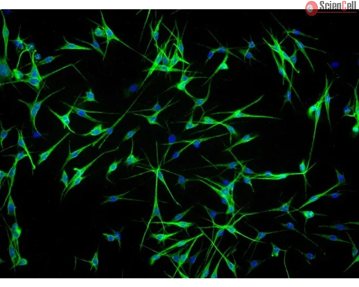 Human Epidermal Melanocyte-adult (HEM-a) - Immunostaining for S100-β, 100x.
