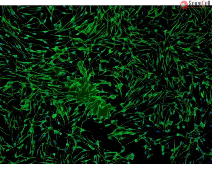 Human Epidermal Melanocytes-light (HEM-l) - Immunostaining for S100-β, 100x.
